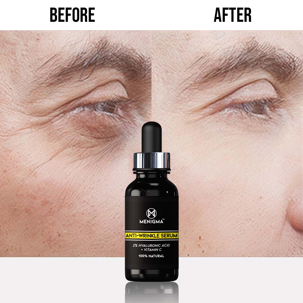 Anti-Wrinkle Serum