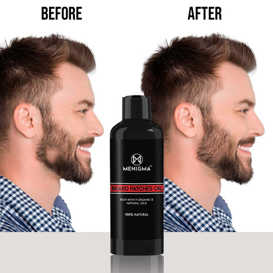 Beard Patches Oil